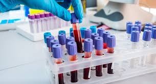 Laboratory technician preparing a blood test sample