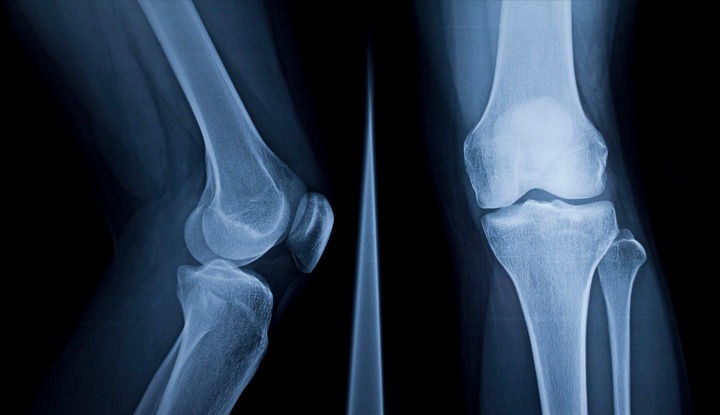 Doctor analyzing an X-ray film